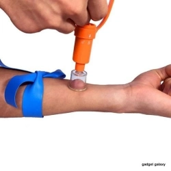 מחלץ עקיצות חרקים